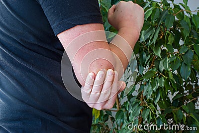 Pain in elbow concept photo. Person holds with palm of other hand over area of â€‹â€‹elbow due to occurrence of severe pain Stock Photo